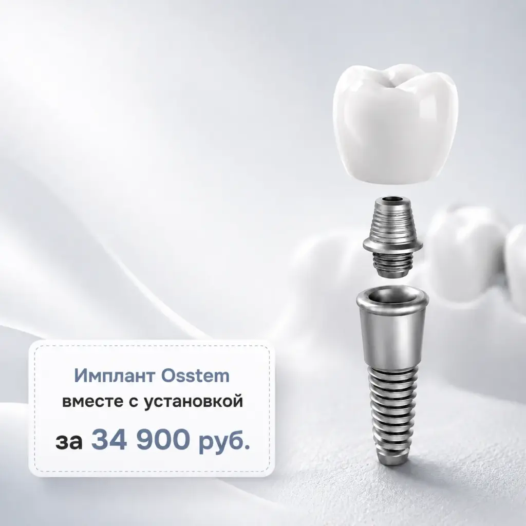 Имплант Osstem с установкой за 34 900 ₽